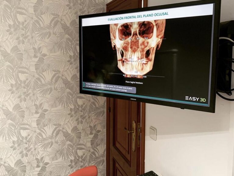 Diagnóstico 3D en Ortodoncia