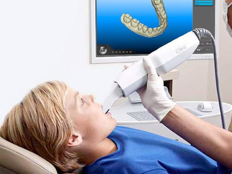 Escáner Intraoral